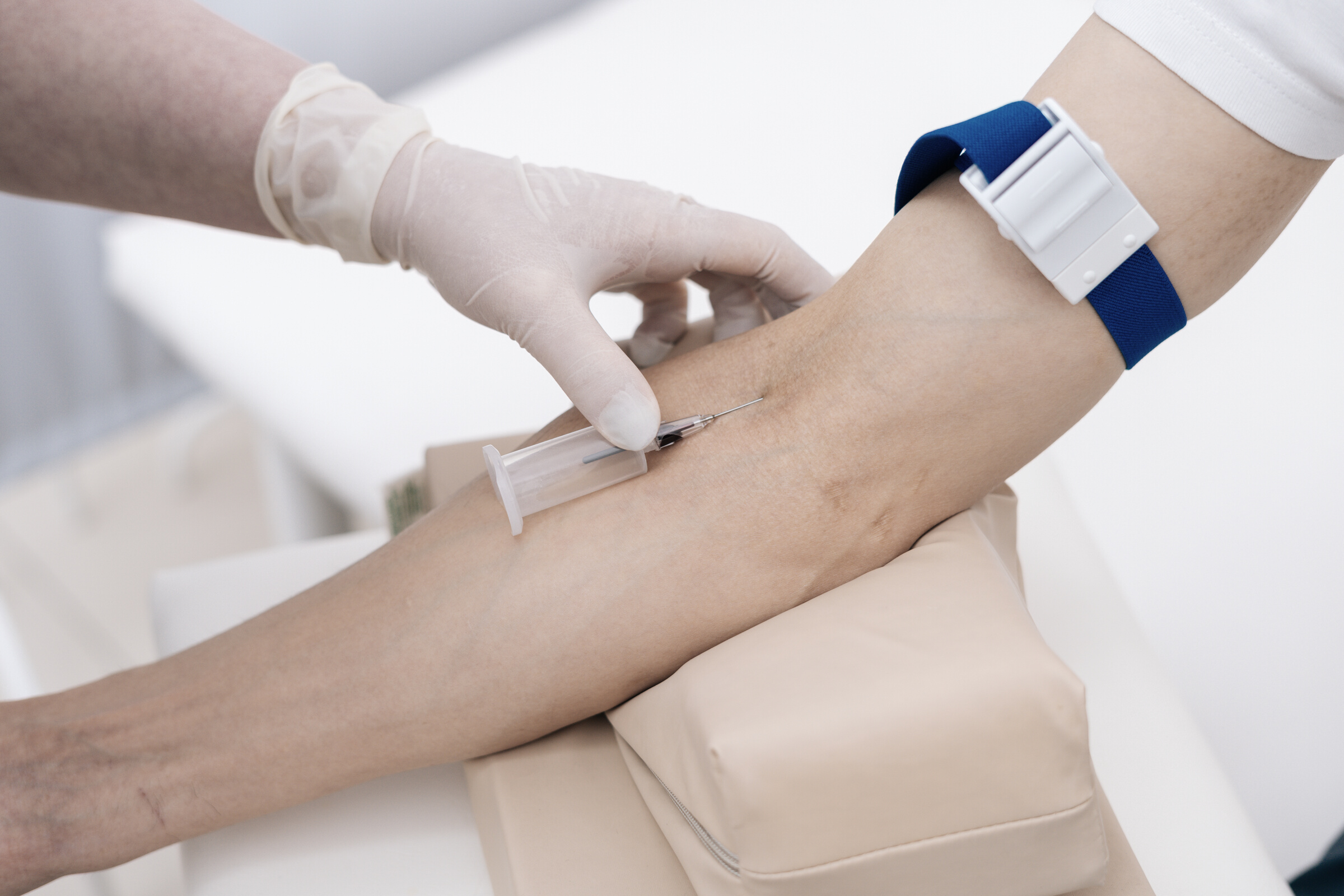 Laboratory assistant collecting blood sample from veins with vacuum capsule.